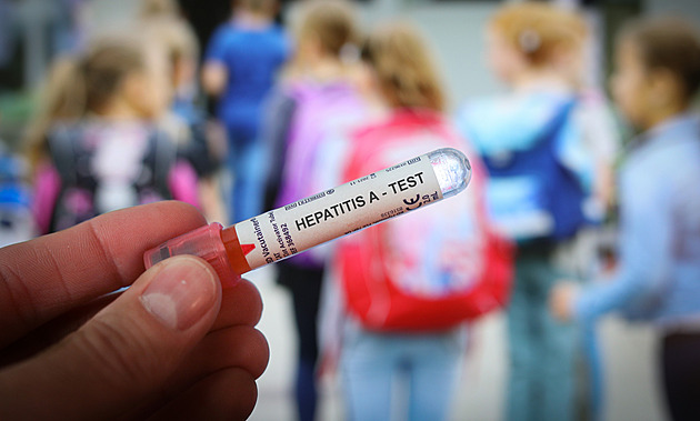 Žloutenka v Česku už zneklidňuje i Němce. Píší o razantním nárůstu případů