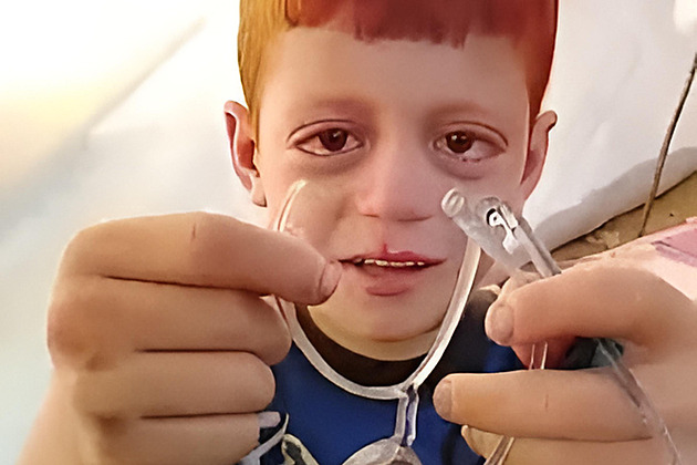 GLOSA: Mediální kýč dne. Palestinskému chlapečkovi se rozbily brejličky
