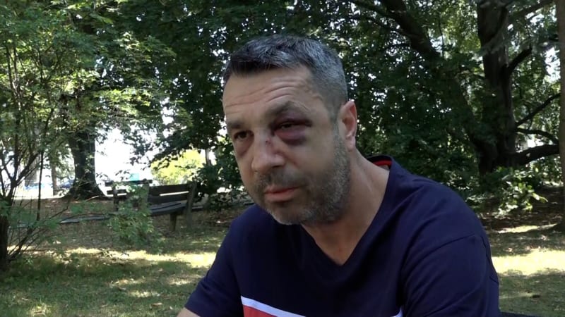 Přeražený nos a zlomená očnice: Surové napadení natočila kamera, už ho šetří slovenská policie